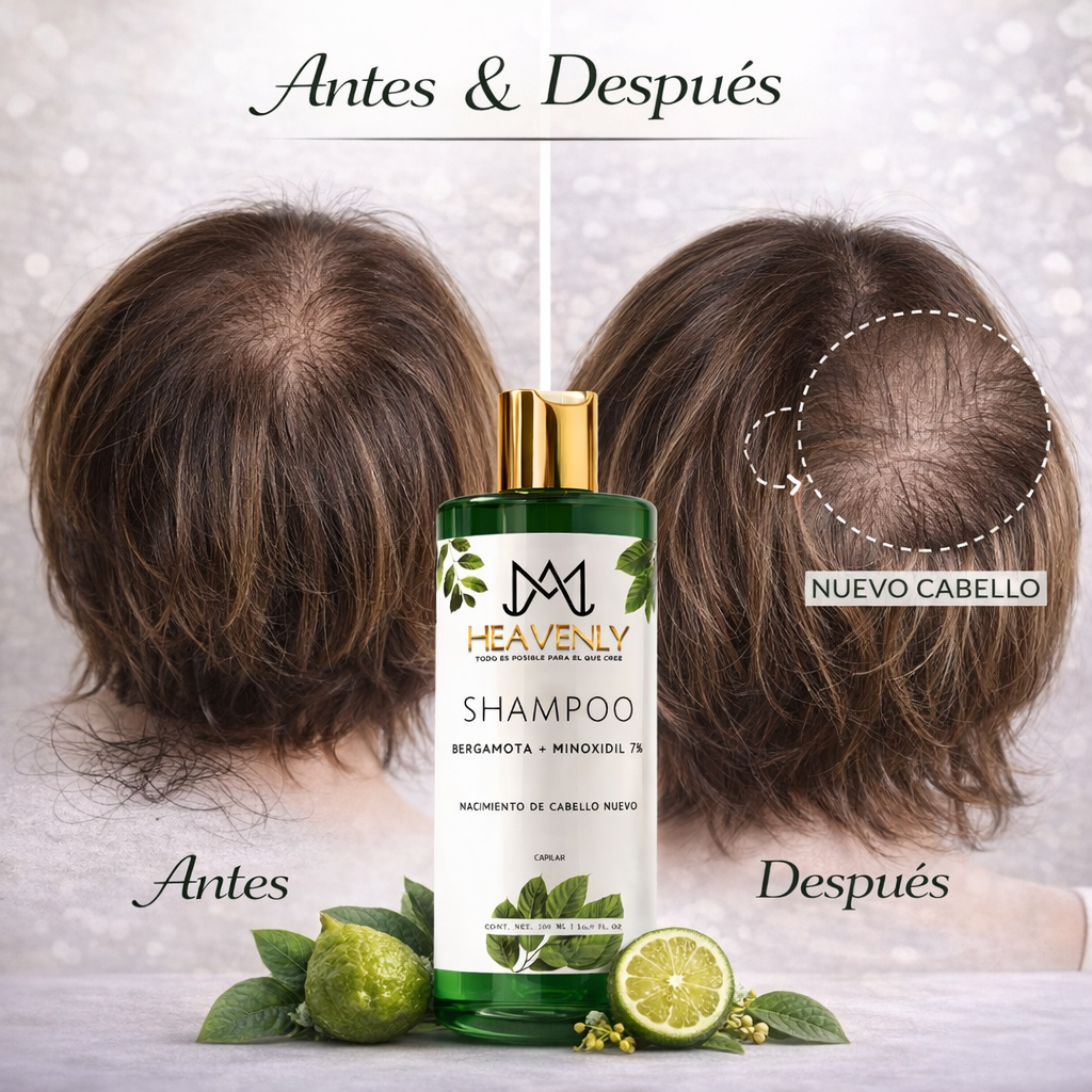 Shampoo Bergamota + minoxidil 7 %